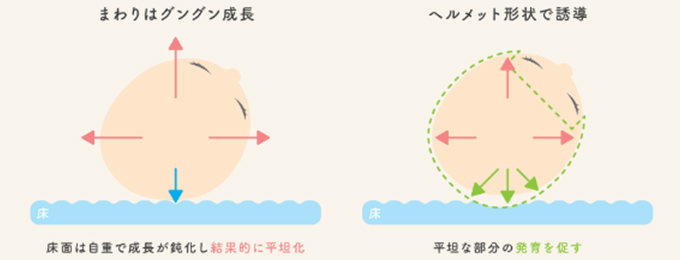頭蓋の成長誘導のイラスト